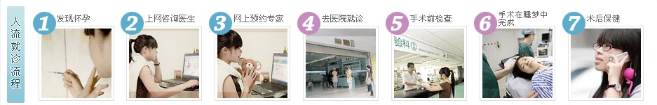 如何做人流