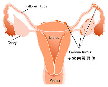 子宫内膜