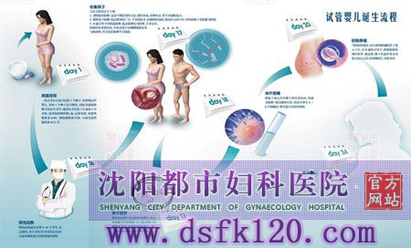 试管婴儿